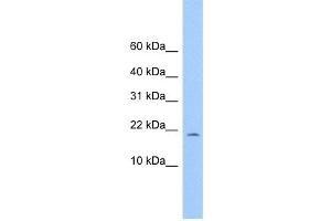 WB Suggested Anti-C10orf83 Antibody Titration: 0. (MORN4 抗体  (Middle Region))