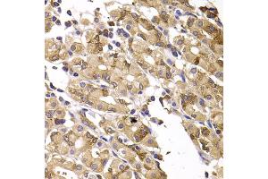 Immunohistochemistry of paraffin-embedded human gastric injury using ASMTL antibody (ABIN5975463) at dilution of 1/100 (40x lens). (ASMTL 抗体)