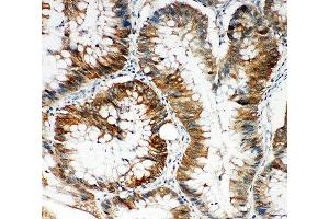Immunohistochemistry (IHC) image for anti-KH Domain Containing, RNA Binding, Signal Transduction Associated 1 (KHDRBS1) (N-Term) antibody (ABIN3031544)
