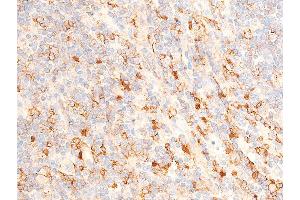 ABIN6267224 at 1/100 staining human appendiceal tissue sections by IHC-P. (CHEK1 抗体  (pSer317))