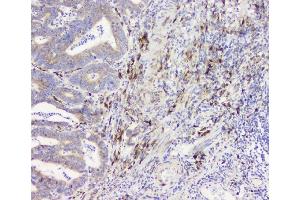 IHC analysis of RRBP1 using anti-RRBP1 antibody (ABIN6719628). (RRBP1 抗体)