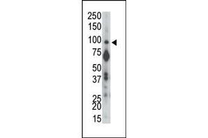 The anti-PTPalpha N-term Pab (ABIN392834 and ABIN2842259) is used in Western blot to detect PTPalpha in mouse brain tissue lysate. (PTPRA 抗体  (N-Term))