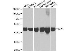 Western blot analysis of extracts of various cell lines, using GDA Antibody. (GDA 抗体  (AA 165-454))