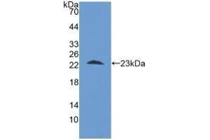 Detection of Recombinant STIP1, Human using Polyclonal Antibody to Stress Induced Phosphoprotein 1 (STIP1) (STIP1 抗体  (AA 1-169))