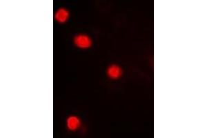 Immunofluorescent analysis of MAPKAPK3 staining in Hela cells. (MAPKAP Kinase 3 抗体  (C-Term))