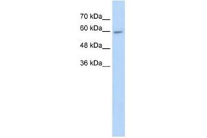 Western Blotting (WB) image for anti-Cytochrome P450, Family 4, Subfamily F, Polypeptide 11 (CYP4F11) (N-Term) antibody (ABIN630445)
