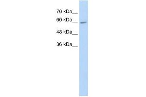 CYP4F11 antibody used at 5 ug/ml to detect target protein. (CYP4F11 抗体  (N-Term))