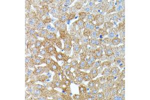 Immunohistochemistry of paraffin-embedded mouse liver using Haptoglobin (Haptoglobin (HP)) antibody (ABIN3022157, ABIN3022158, ABIN1513029, ABIN1514188 and ABIN6218636) at dilution of 1:100 (40x lens). (Haptoglobin 抗体)