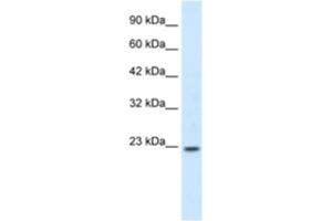 Western Blotting (WB) image for anti-Homeobox B6 (HOXB6) antibody (ABIN2460208) (HOXB6 抗体)