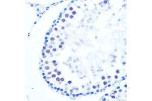 Immunohistochemistry of paraffin-embedded rat testis using DNA Polymerase beta Rabbit mAb (ABIN7269456) at dilution of 1:100 (40x lens). (POLB 抗体)