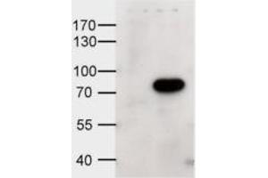 Western Blotting (WB) image for anti-ATP-Binding Cassette, Sub-Family D (Ald), Member 1 (ABCD1) (Internal Region) antibody (ABIN2465335) (ABCD1 抗体  (Internal Region))