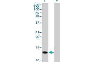 Western Blot analysis of CMTM1 expression in transfected 293T cell line by CMTM1 MaxPab polyclonal antibody. (CMTM1 抗体  (AA 1-114))