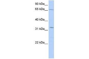Western Blotting (WB) image for anti-Tripartite Motif Containing 22 (TRIM22) antibody (ABIN2458333) (TRIM22 抗体)