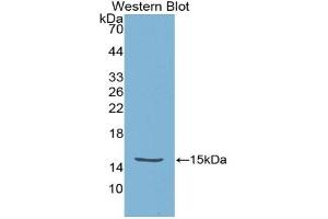 Detection of Recombinant HTRA1, Escherichia coli using Polyclonal Antibody to High Temperature Requirement Factor A1 (HTRA1) (HTRA1 抗体  (AA 304-442))