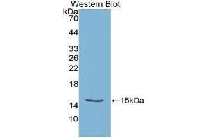 Detection of Recombinant HTRA1, Escherichia coli using Polyclonal Antibody to High Temperature Requirement Factor A1 (HTRA1) (High Temperature Requirement Factor A1 (AA 304-442) 抗体)