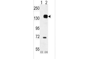 Western blot analysis of TEK (arrow) using rabbit polyclonal TEK Antibody (C-term) (ABIN392059 and ABIN2841824). (TEK 抗体  (C-Term))