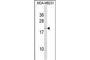 Western blot analysis in MDA-MB231 cell line lysates (35ug/lane). (IFNA6 抗体  (C-Term))