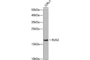 Western blot analysis of extracts of 22Rv1 cells, using RLN2 antibody (ABIN6129627, ABIN6146976, ABIN6146977 and ABIN6222724) at 1:1000 dilution. (Relaxin 2 抗体  (AA 25-185))