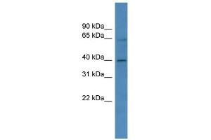 WB Suggested Anti-ZNF579 Antibody Titration:  0. (ZNF579 抗体  (C-Term))