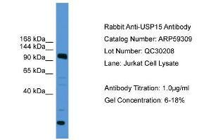 WB Suggested Anti-USP15  Antibody Titration: 0. (USP15 抗体  (C-Term))