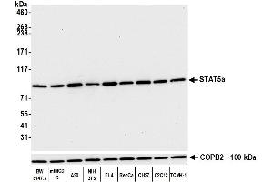 Western Blotting (WB) image for anti-Signal Transducer and Activator of Transcription 5A (STAT5A) (AA 744-794) antibody (ABIN7454017)