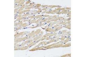 Immunohistochemistry of paraffin-embedded rat heart using NPPA antibody.
