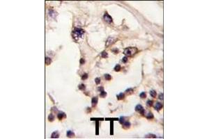 Formalin-fixed and paraffin-embedded human testis tissue reacted with TESK2 antibody (Center) f , which was peroxidase-conjugated to the secondary antibody, followed by DAB staining. (TESK2 抗体  (AA 210-240))