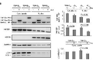 ROS and HMGB1 distribution in starvation-stressed TBP/Q36~79 293 cells. (Histone H3.3B 抗体  (full length))