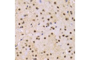 Immunohistochemistry of paraffin-embedded mouse brain using SNRPE Antibody (ABIN1876676) at dilution of 1:100 (40x lens). (SNRPE 抗体)