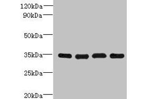 Western blot All lanes: DNAJC17 antibody at 16 μg/mL Lane 1: A431 whole cell lysate Lane 2: Hela whole cell lysate Lane 3: Raji whole cell lysate Lane 4: HepG2 whole cell lysate Secondary Goat polyclonal to rabbit IgG at 1/10000 dilution Predicted band size: 35 kDa Observed band size: 35 kDa (DNAJC17 抗体  (AA 1-304))