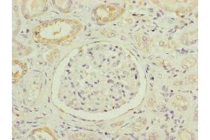 Immunohistochemistry (IHC) image for anti-NADH Dehydrogenase (Ubiquinone) 1 beta Subcomplex, 5, 16kDa (NDUFB5) (AA 100-189) antibody (ABIN7160924)