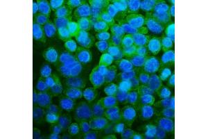 IF analysis of RPL13A using anti-RPL13A antibody (ABIN7600471).