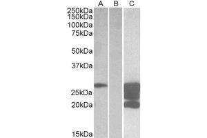 HEK293 lysate (10 µg protein in RIPA buffer) overexpressing Human GM2A with DYKDDDDK tag probed with AP23748PU-N (1. (GM2A 抗体  (Internal Region))