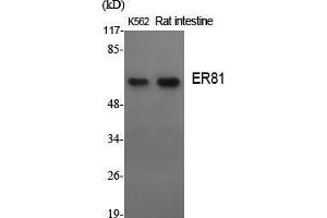 Western Blot (WB) analysis of specific cells using ER81 Polyclonal Antibody.