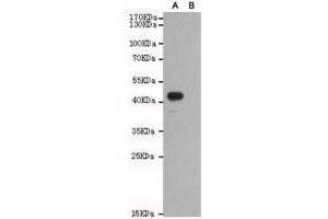 Western blot of Wnt5b A) transfected and (B) untransfected CHO-K1 cell lysate with WNT5B antibody at 1:1000. (WNT5B 抗体)