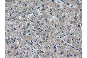 Immunohistochemical staining of paraffin-embedded liver tissue using anti-IDH3Amouse monoclonal antibody. (IDH3A 抗体)