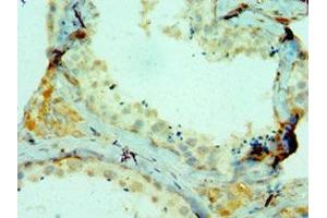 Immunohistochemistry (IHC) image for anti-Collagen, Type I, alpha 1 (COL1A1) (AA 521-680) antibody (ABIN7148221)