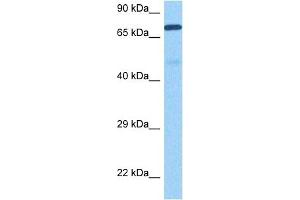 Western Blotting (WB) image for anti-Matrix Metallopeptidase 9 (Gelatinase B, 92kDa Gelatinase, 92kDa Type IV Collagenase) (MMP9) (N-Term) antibody (ABIN2777743)
