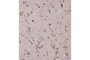 Immunohistochemical analysis of C on paraffin-embedded Human brain tissue was performed on the Leica®BOND RXm. (CBS 抗体  (AA 301-330))