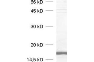 dilution: 1 : 1000, sample: crude synaptosomal fraction of rat brain (P2) (VAMP2 抗体  (AA 2-17))