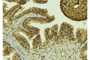 ABIN6276466 at 1/100 staining Mouse colon tissue by IHC-P.