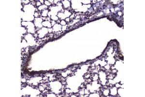 IHC testing of FFPE mouse lung tissue with NFIB antibody at 1ug/ml. (NFIB 抗体)