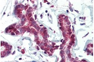 Human Breast (formalin-fixed, paraffin-embedded) stained with SETD7 antibody ABIN364315 at 5 ug/ml followed by biotinylated anti-mouse IgG secondary antibody ABIN481714, alkaline phosphatase-streptavidin and chromogen. (SETD7 抗体)