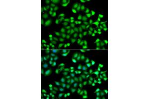 Immunofluorescence analysis of A549 cells using MAPKAPK3 antibody (ABIN5974743). (MAPKAP Kinase 3 抗体)