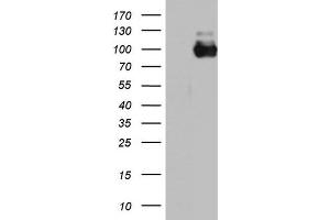 Western Blotting (WB) image for anti-Angiotensin I Converting Enzyme 2 (ACE2) (AA 18-237) antibody (ABIN2715653) (ACE2 抗体  (AA 18-237))