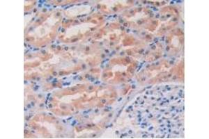 IHC-P analysis of Human Kidney Tissue, with DAB staining. (ITGB1 抗体  (AA 140-383))