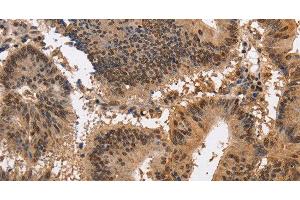 Immunohistochemistry (Paraffin-embedded Sections) (IHC (p)) image for anti-Potassium Voltage-Gated Channel, Subfamily G, Member 2 (Kcng2) antibody (ABIN7239134)