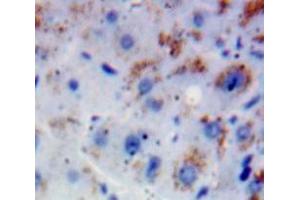 Used in DAB staining on fromalin fixed paraffin-embedded Liver tissue (FGFR2 抗体  (AA 157-377))