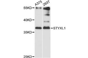 Western blot analysis of extracts of various cell lines, using STYXL1 antibody (ABIN6293878) at 1:3000 dilution. (STYXL1 抗体)