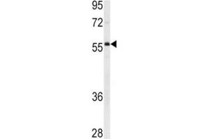 Western Blotting (WB) image for anti-X-Linked Inhibitor of Apoptosis (XIAP) (AA 1-30) antibody (ABIN3029644)